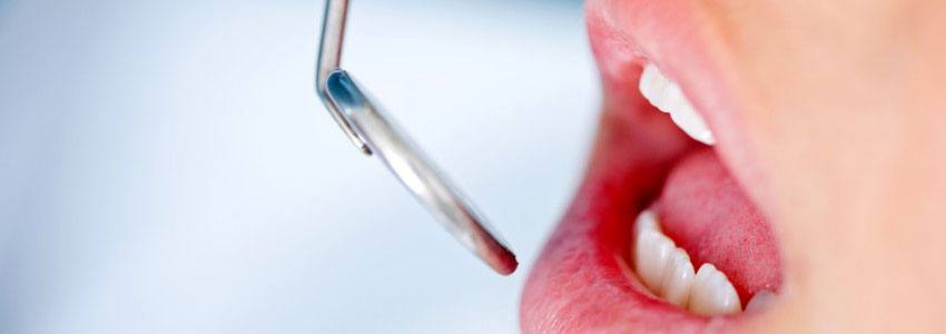 Petit miroir de dentiste devant une bouche