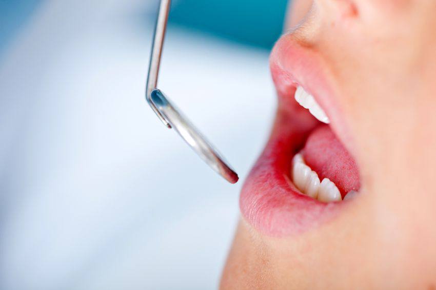 Petit miroir de dentiste devant une bouche